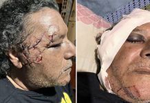 INVESTIGAN COMO INTENTO DE HOMICIDIO EL BRUTAL ATAQUE A PADRE E HIJO PARA ROBARLES LAS BICICLETAS