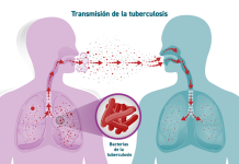 LA TUBERCULOSIS CRECE EN ARGENTINA: LOS CASOS AUMENTARON 71,6% DESDE 2020 Y YA SE REGISTRA UNA MUERTE CADA SIETE HORAS