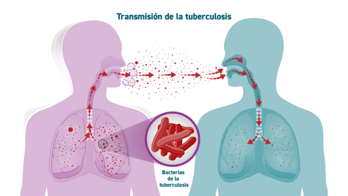 TB-Transmission_Spanish_1200x675