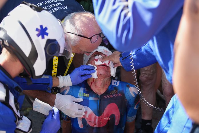 Escandaloso accidente en el Tour de France: un ciclista chocó contra un auto que frenó de golpe, recibió 20 puntos en el rostro y abandonó la carrera