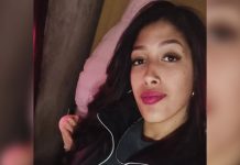 Horror en Tres de Febrero: se asomó por la ventana de su casa, le arrojaron ácido en la cara y podría perder la vista
