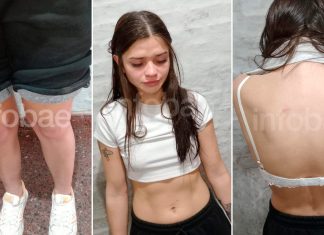 El informe forense sobre las lesiones de la joven acusada de matar a su novio en Chaco y la “amnesia lacunar” que plantea su defensa