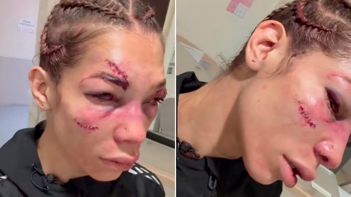 La argentina Sofía Montenegro mostró cómo quedó su rostro tras la sangrienta pelea que perdió en su debut en UFC