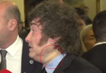 El Gobierno informó la razón por la que Javier Milei usó una venda durante su viaje a España