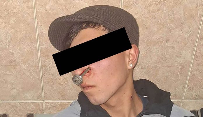 La Matanza: se peleó por el amor de una mujer y le clavaron una llave en la cara